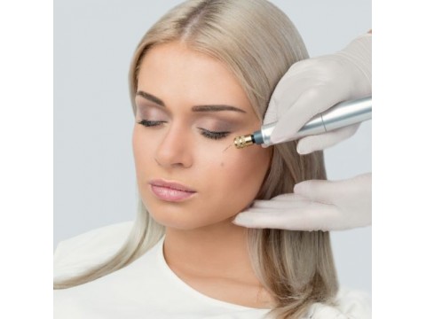 Vokų pakėlimas/paakių raukšlių mažinimo plazma liftingas FIBROBLAST 60 min, "OLD TOWN SPA" masažo ir grožio klinikoje Vilniuje